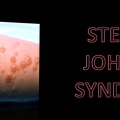 HOMOEOPATHIC APPROACH IN STEVENS – JOHNSON SYNDROME (SJS)